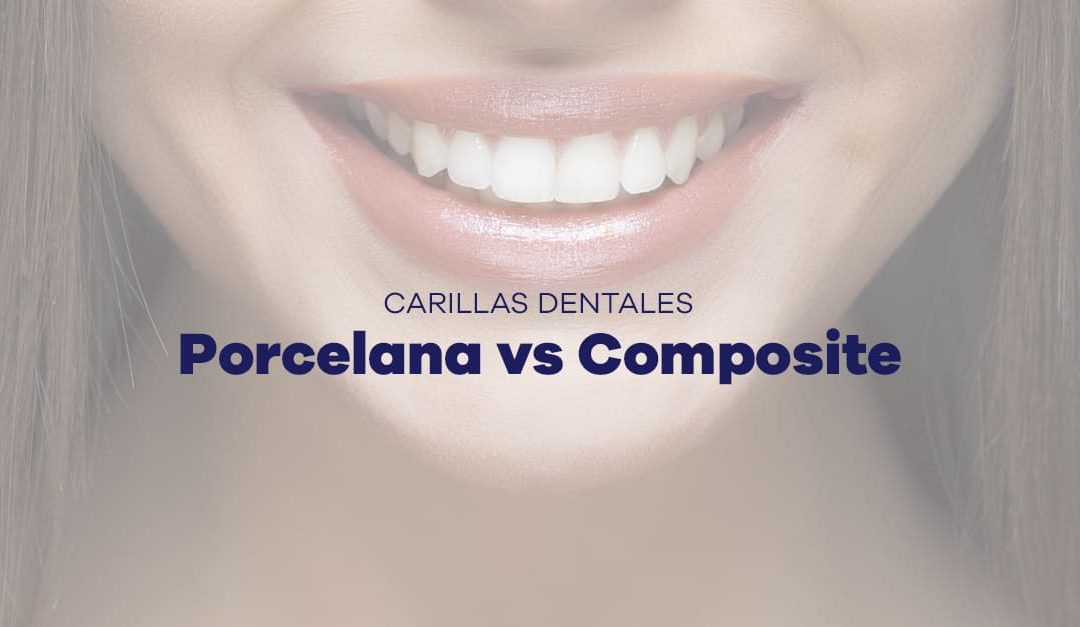 Diferencias entre carillas de porcelana y carillas de composite: ¿Cuál es la mejor opción para tu sonrisa?