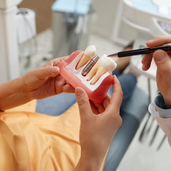 cuidados de los implantes con corona