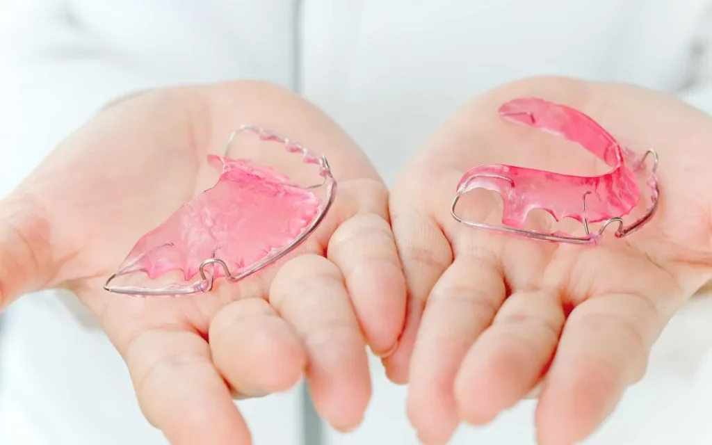 Tipos de retenedores dentales