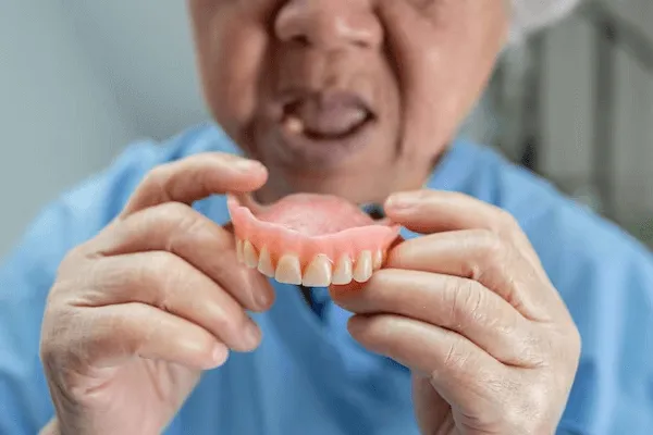 Cuánto cuesta una prótesis dental: Precios y factores a considerar 4 Cuál prótesis dental es más barata