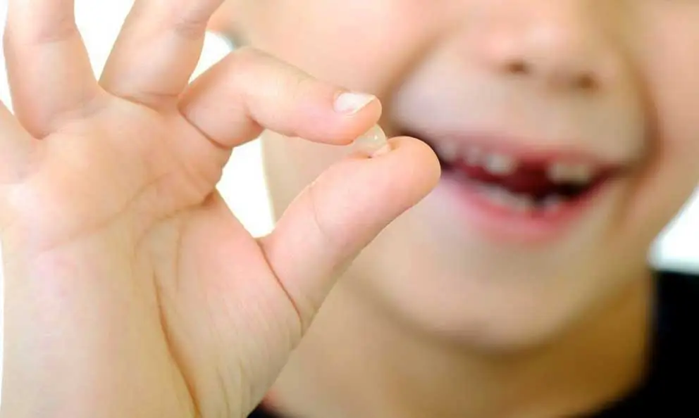 Cómo quitar un diente de leche sin dolor: Guía y consejos prácticos 2 Cómo quitar un diente de leche en casa