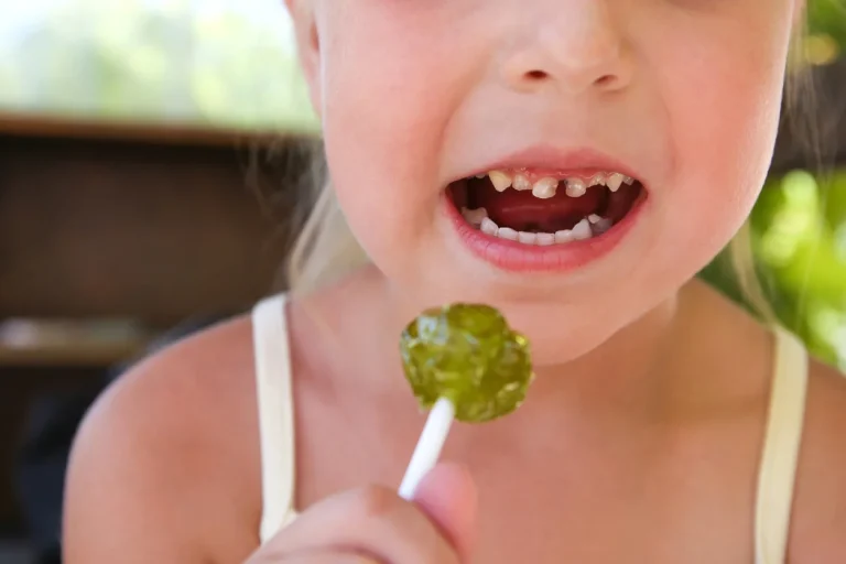 Caries en niños