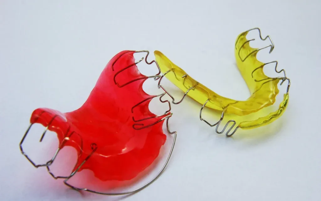 Para qué sirven los retenedores dentales