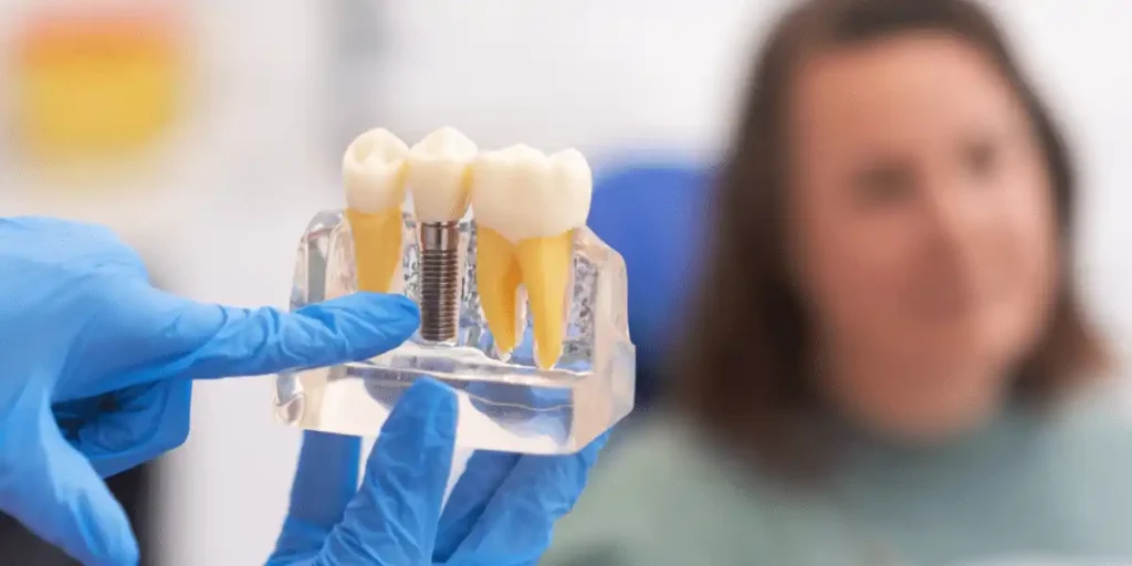 Puedo entrenar después de hacerme un implante dental