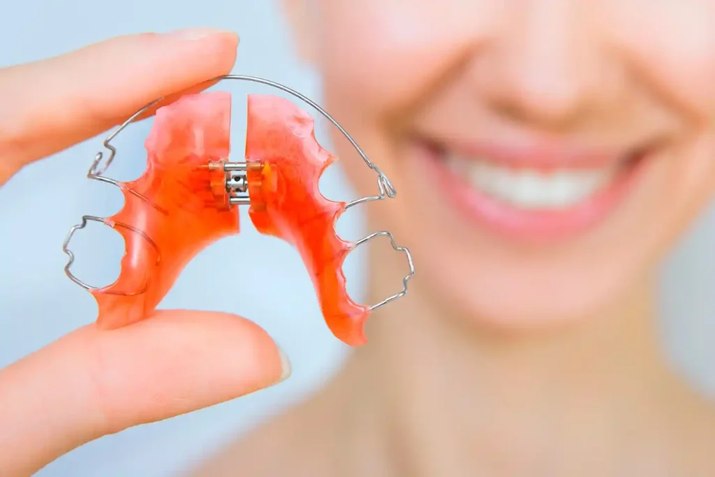 Tiempo de uso de los retenedores dentales
