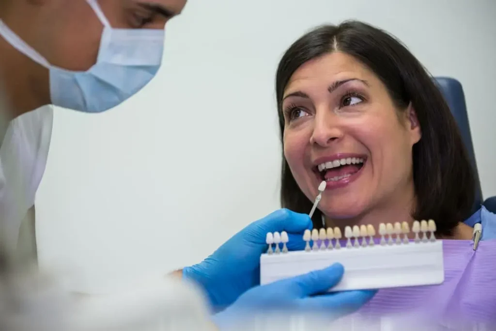 Cada cuánto se deben cambiar las carillas dentales