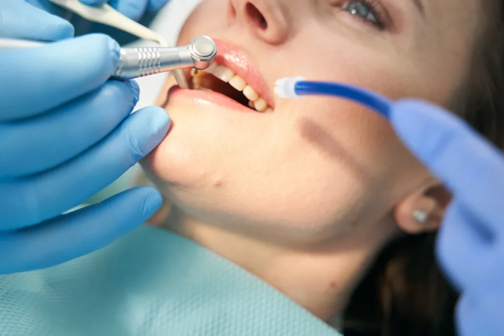 Cuánto dura sacar una muela con endodoncia