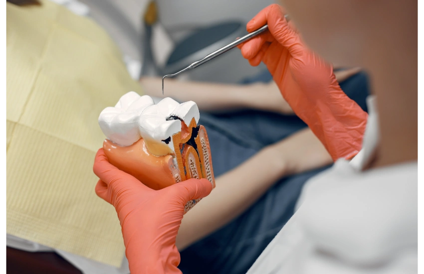Procedimiento de endodoncia