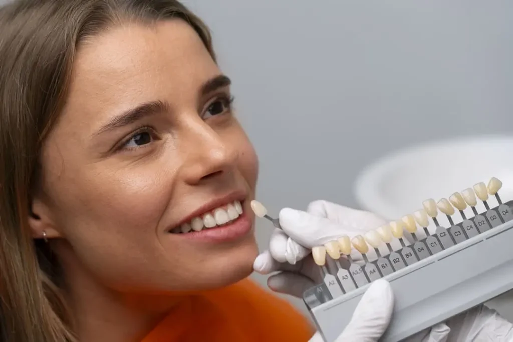 Vida útil de las carillas dentales