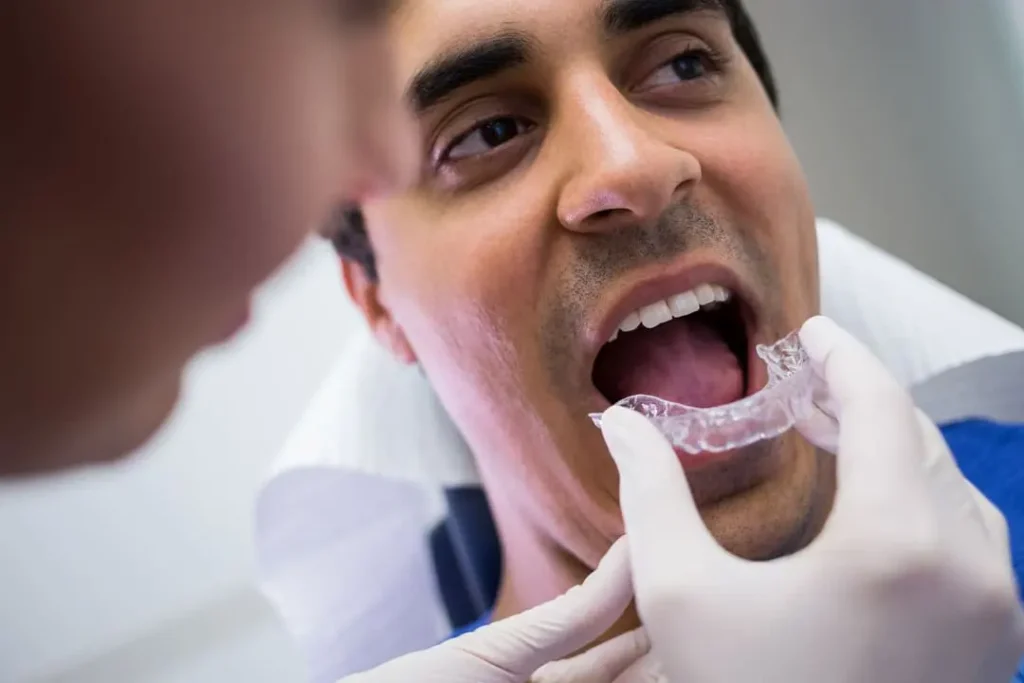 Mantenimiento de las férulas dentales