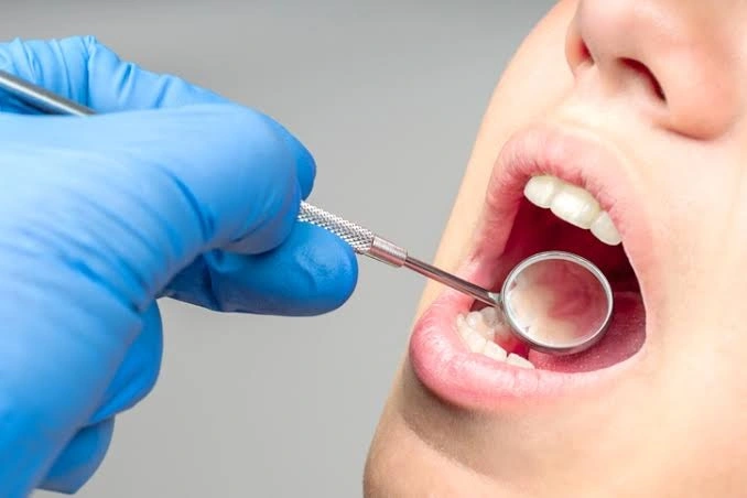 Mantenimiento periodontal
