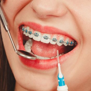 brackets ninos
