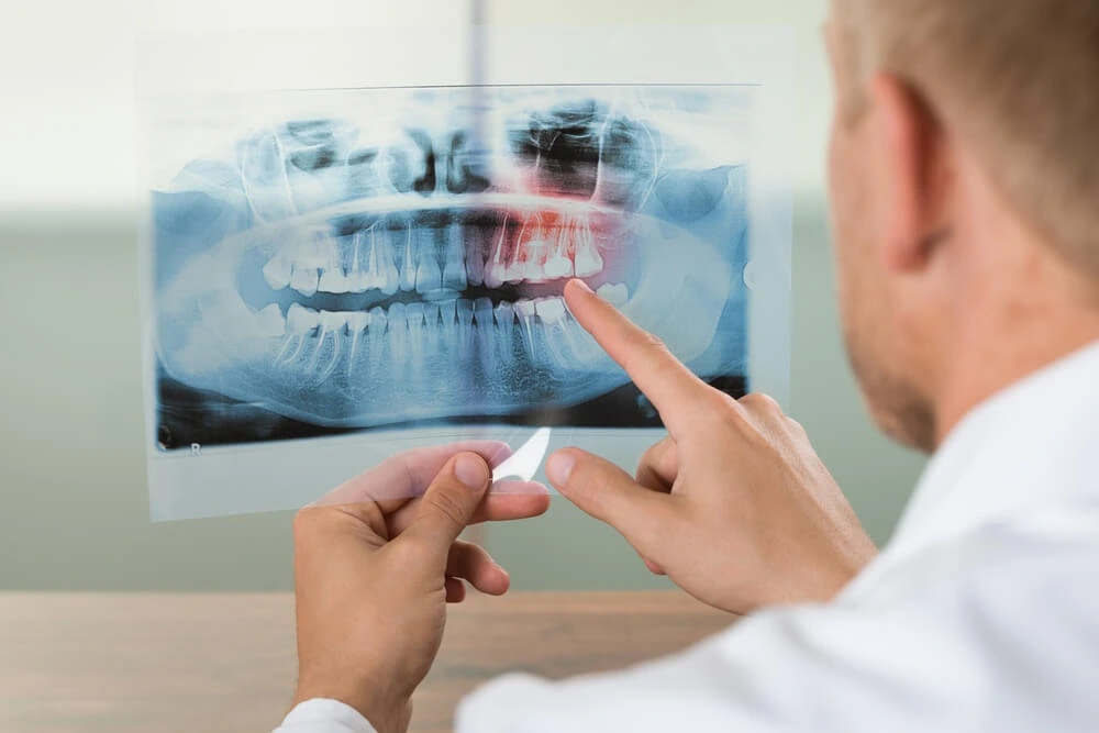 Cubre el seguro dental el precio de una radiografía