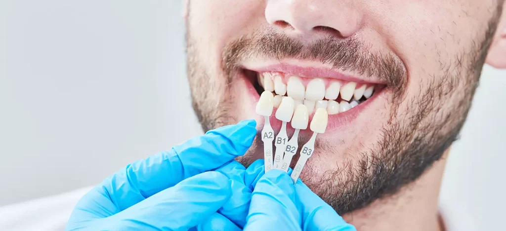 Precio de una reconstrucción dental
